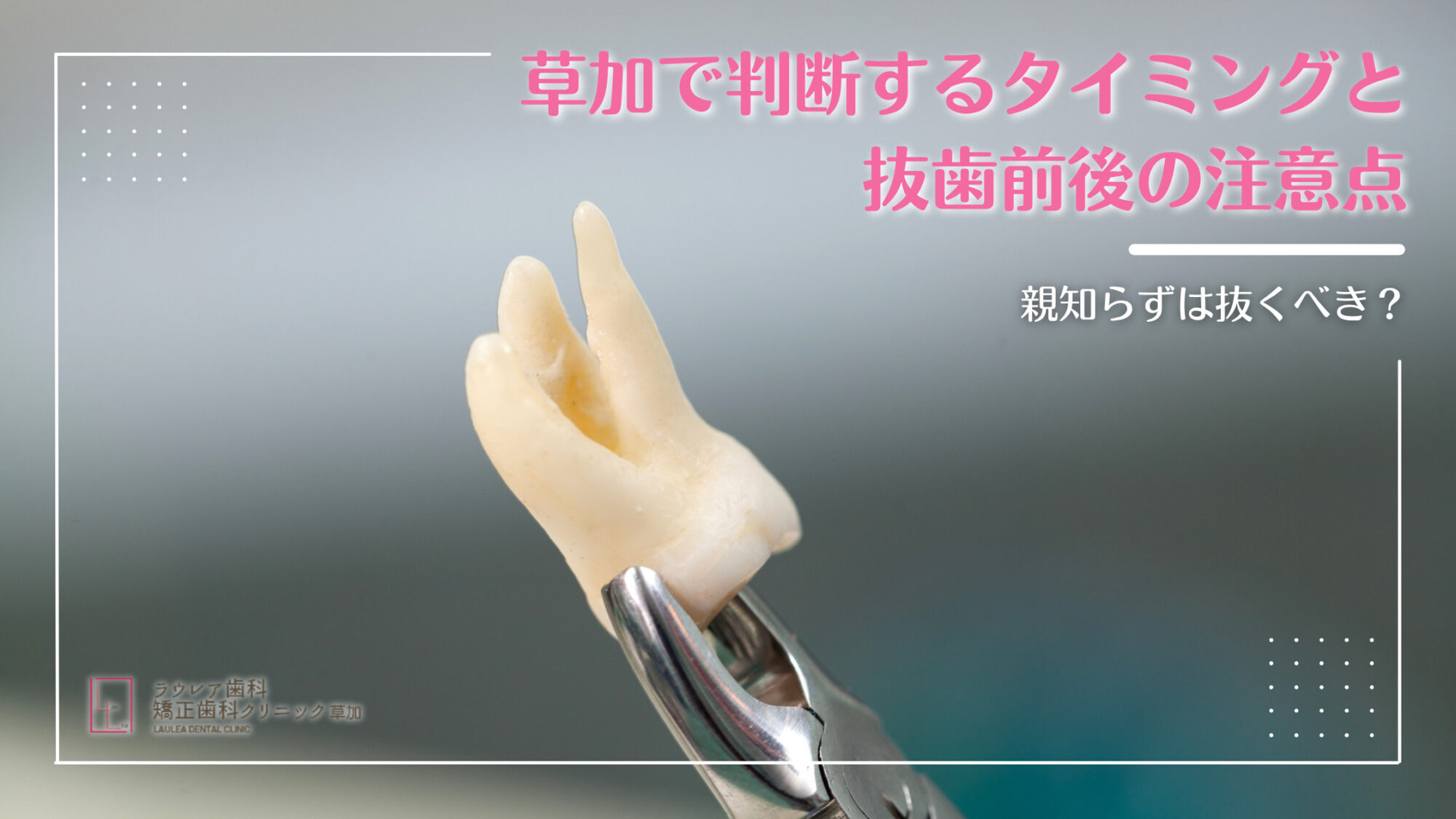 親知らずは「抜く」か「残す」か？後悔しないための判断基準と抜歯前後 